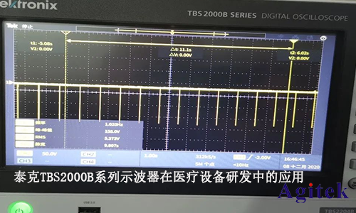 泰克TBS2000B系列示波器在醫療設備研發中的應用